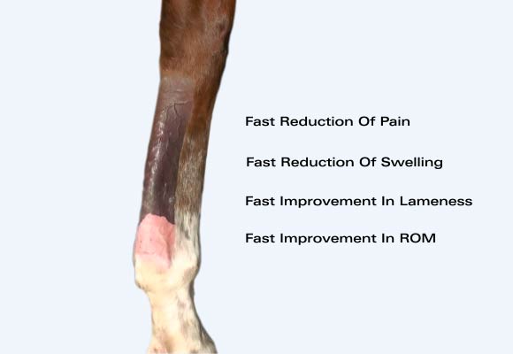 Tendon Injuries: Fast reduction of pain, swelling, inflammation, ROM with VET-2 Sonotron